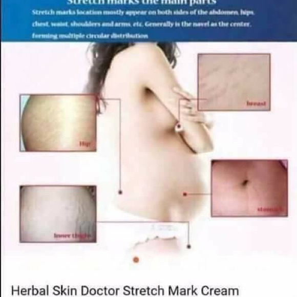 Scarless Cream Acne Stretch Mark Pimple Marks - Picture 6 of 8